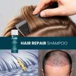 HairMD Hair Repair Shampoo size options – 100 ml, 150 ml, 250 ml, 750 ml