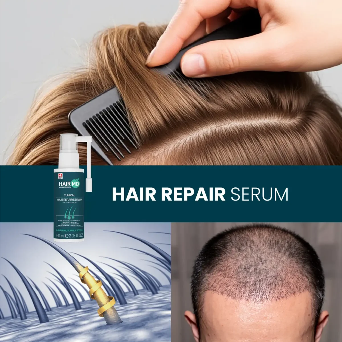 HairMD Hair Repair Serum lifestyle image – hair combing and scalp close-up