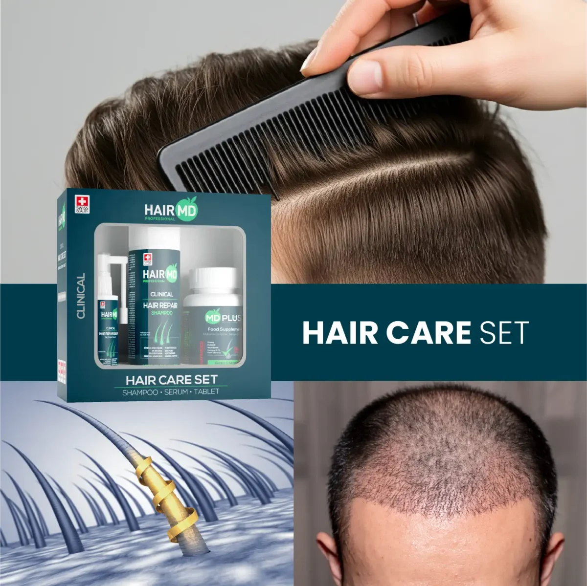 Lifestyle image featuring HairMD Hair Care Set with hair parting and scalp visuals
