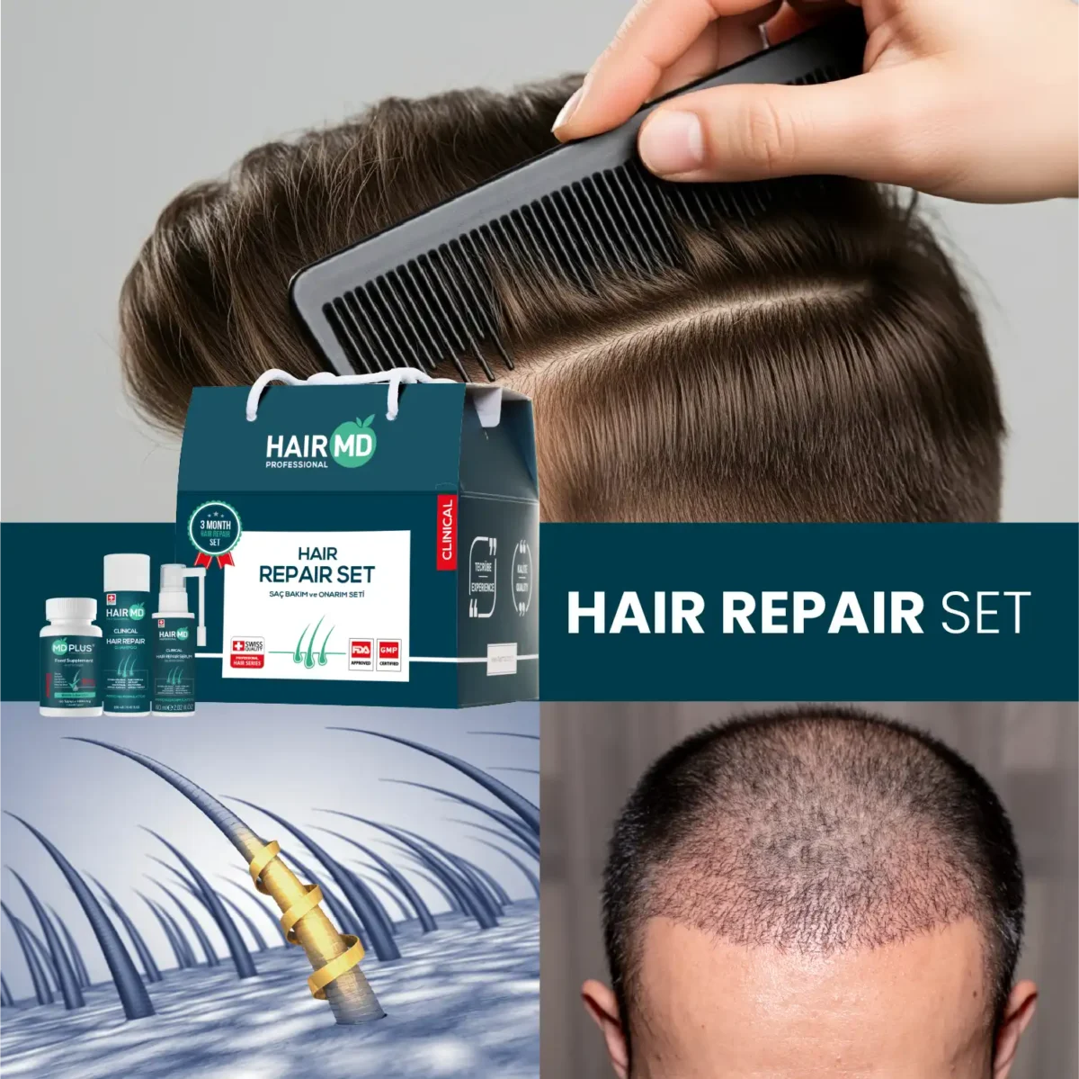 Lifestyle collage with HairMD Hair Repair Set, scalp illustration, and combing scene