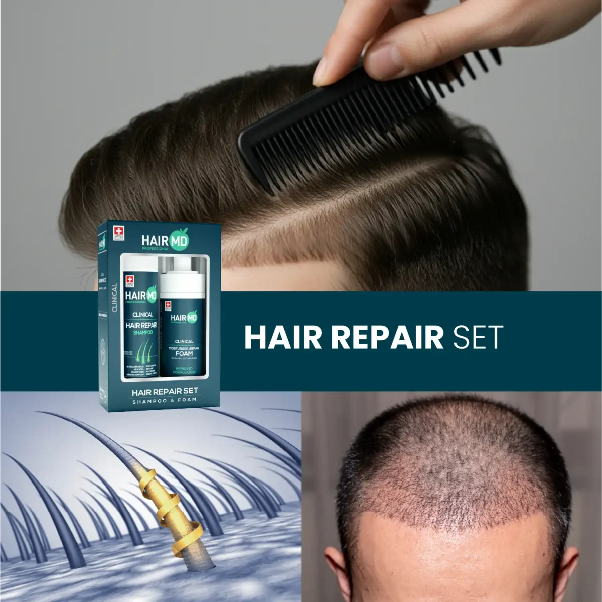 airMD shampoo & foam set box, styled hair close‑up, follicle illustration and scalp photo