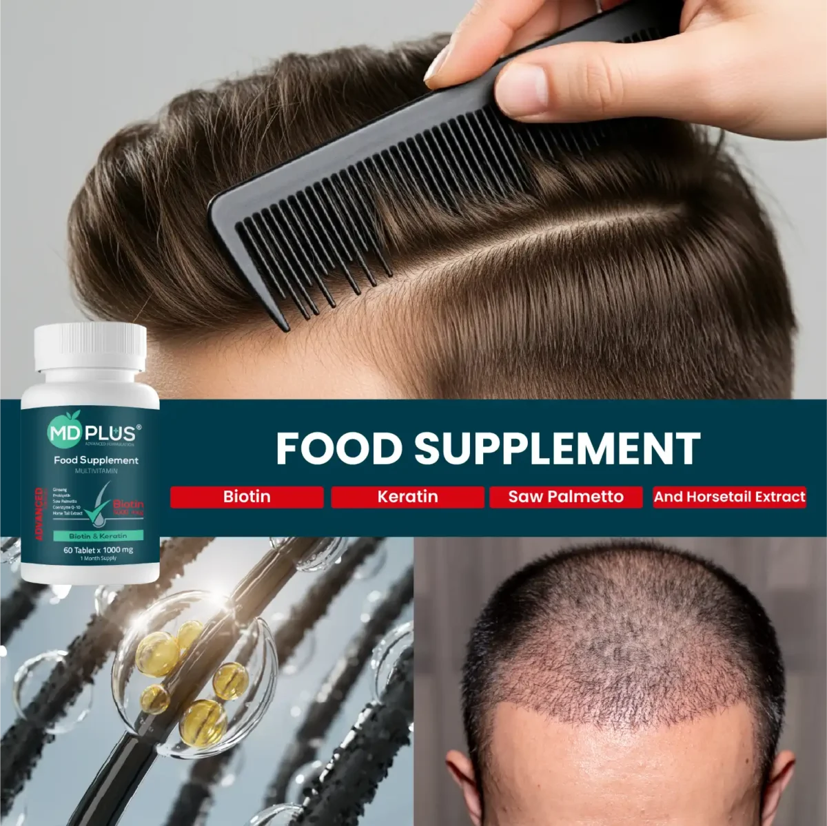 Collage with MD‑Plus bottle, styled hair, oil capsules on strands and scalp photo