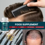 Collage with MD‑Plus bottle, styled hair, oil capsules on strands and scalp photo