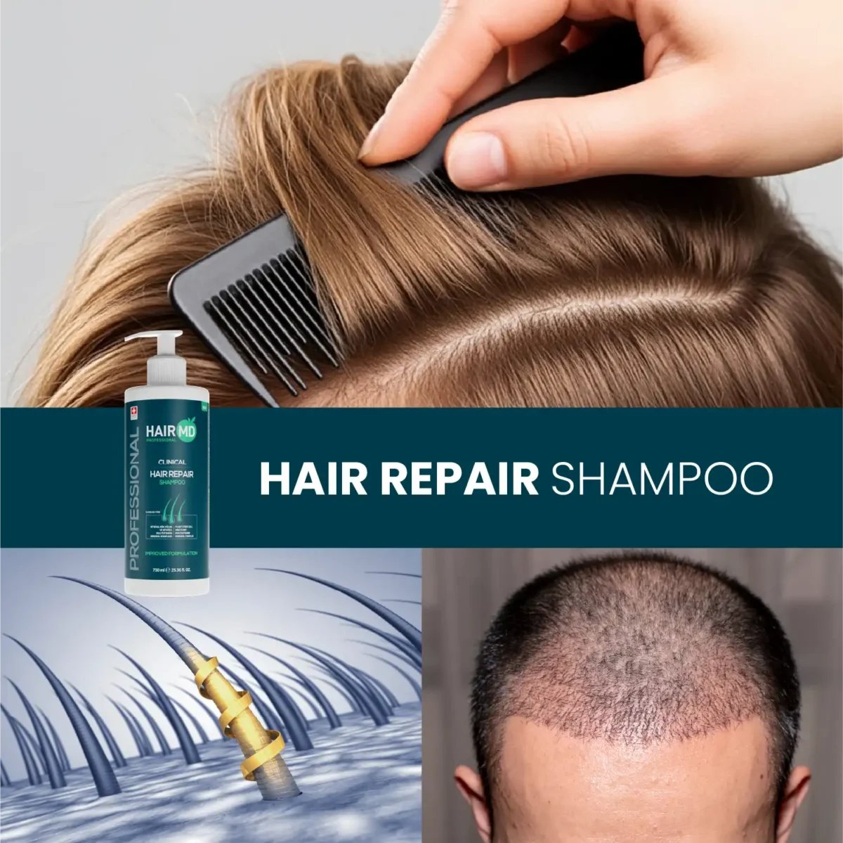 Collage with combed hair, shampoo bottle and scalp visuals