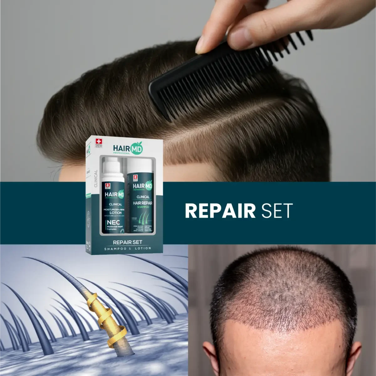 Collage with HairMD Repair Set box, styled hair close‑up, follicle illustration and scalp photo