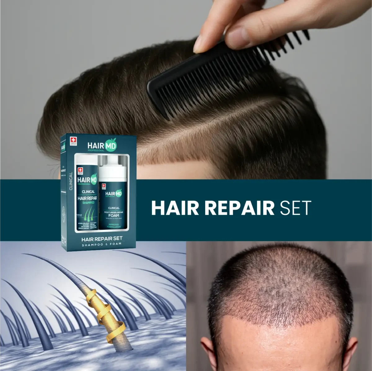 Lifestyle montage featuring HairMD Repair Set box, combed hair, scalp graphic and close cropped scalp