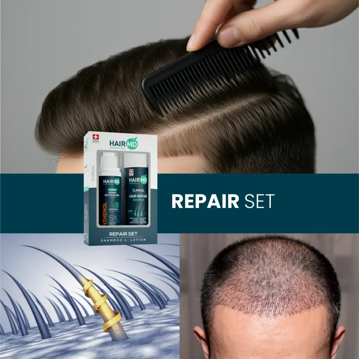 Lifestyle collage with combed hair, scalp illustration and HairMD Repair Set box