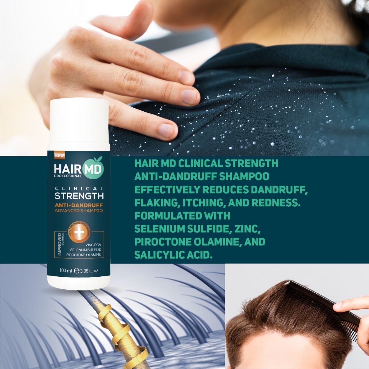 HairMD Clinical Strength Anti-Dandruff Advanced Shampoo 100 ML