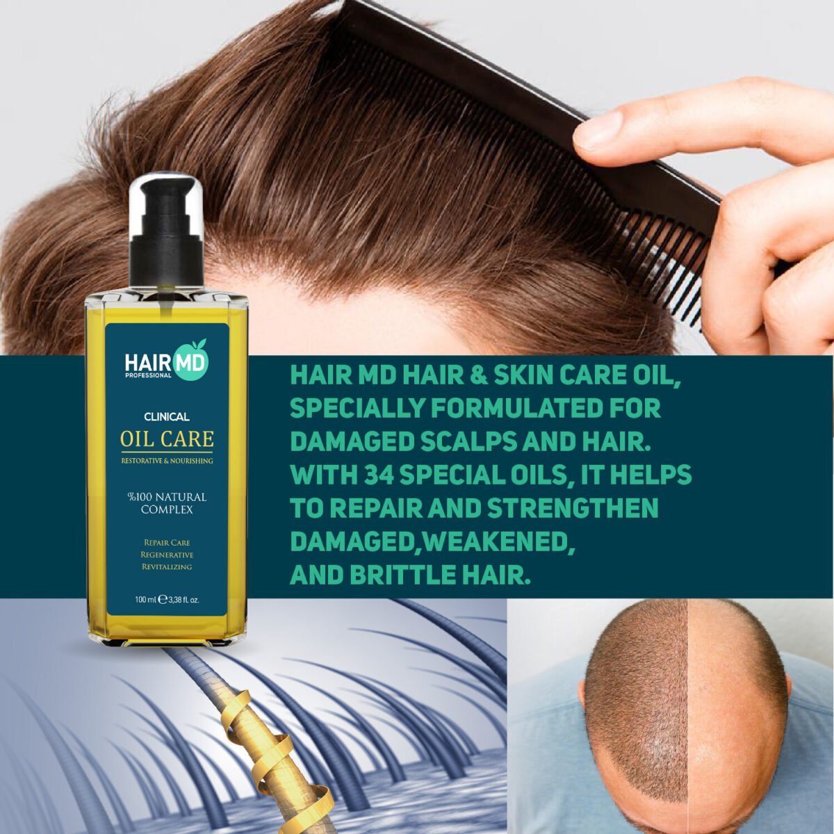 Hair MD Clinical Restorative Nourishing Oil Care 100 Ml