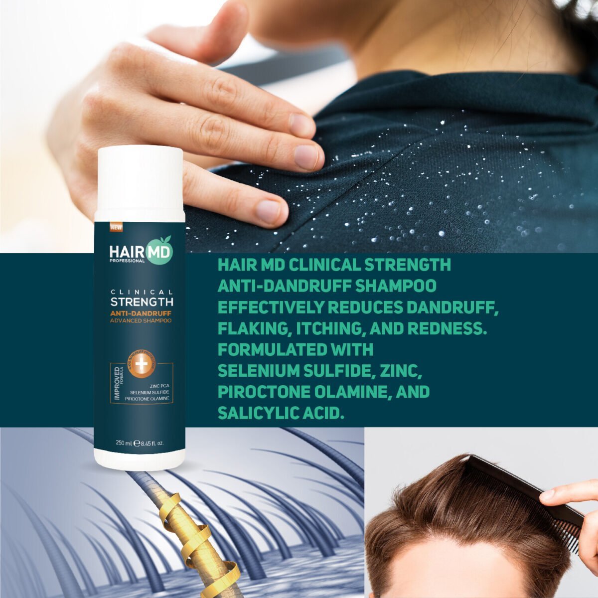 HairMD Clinical Strength Anti-Dandruff Advanced Shampoo 250 ML