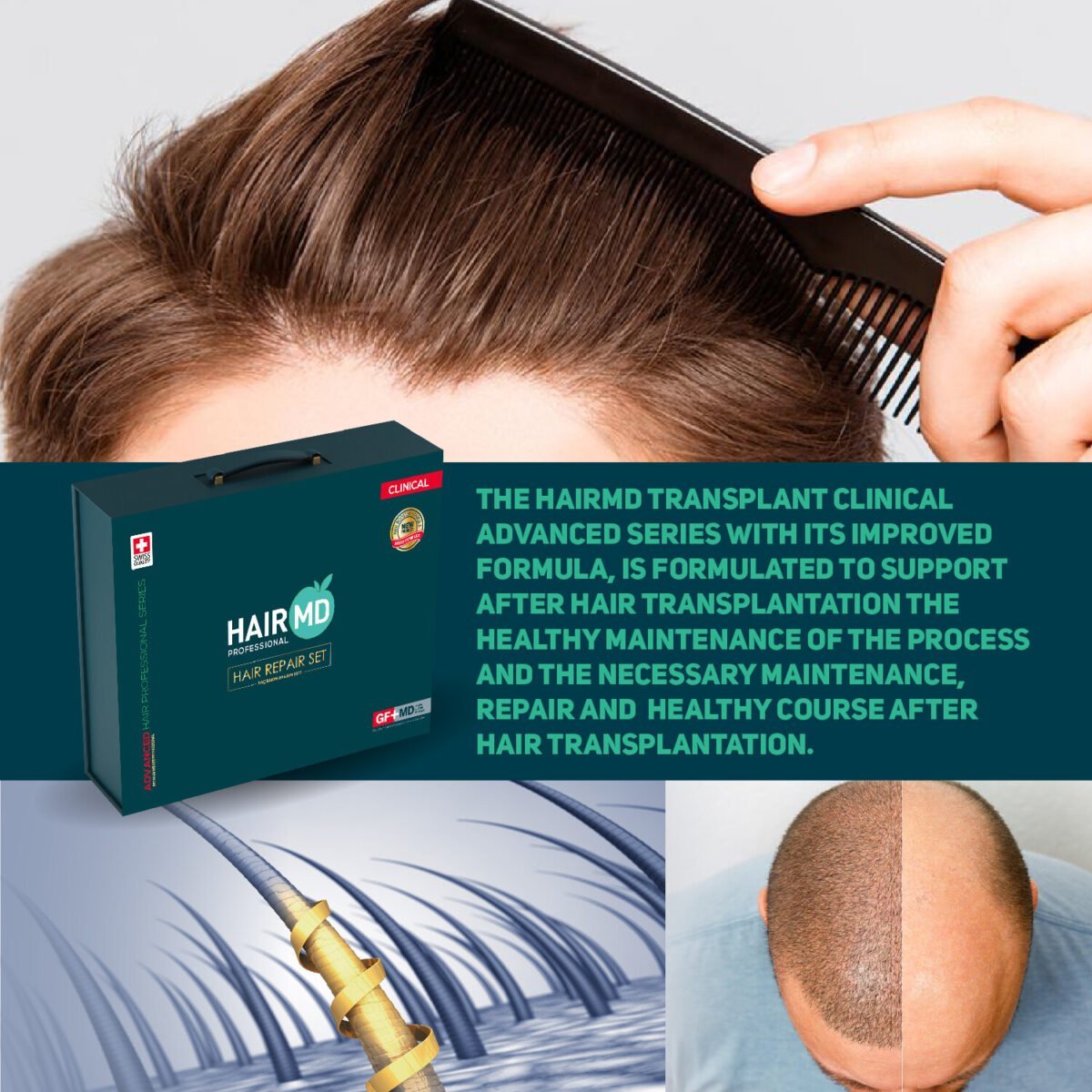 HairMD Hair Repair Set