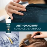 Lifestyle collage showing dandruff on clothing with HairMD Anti‑Dandruff Advanced Shampoo