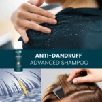 Lifestyle collage with flakes on clothing and HairMD 250 ml anti‑dandruff shampoo
