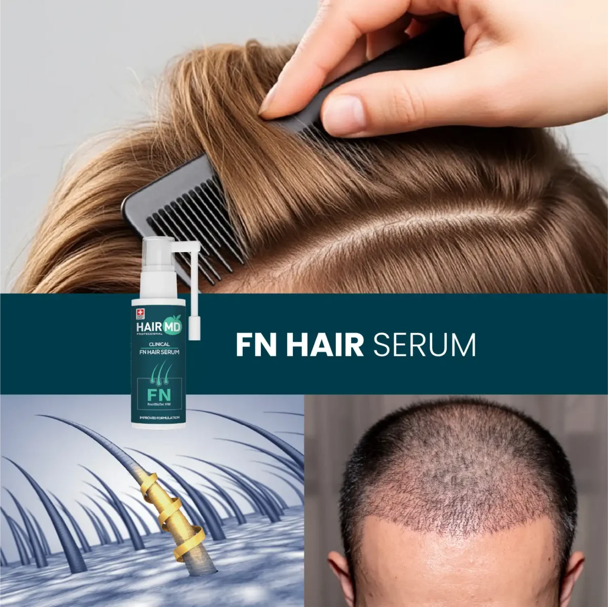 Lifestyle collage showing combing hair, scalp graphic and close‑up head with HairMD FN Hair Serum