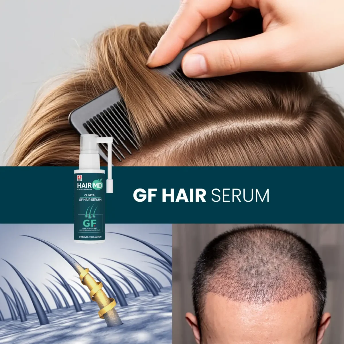 Lifestyle collage featuring combing hair, scalp graphic and close‑up head with HairMD GF+ Hair Serum