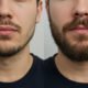 HairMD Professional Beard Serum