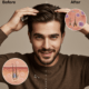 Effect of HairMD Hair Care Products on Hair Follicles
