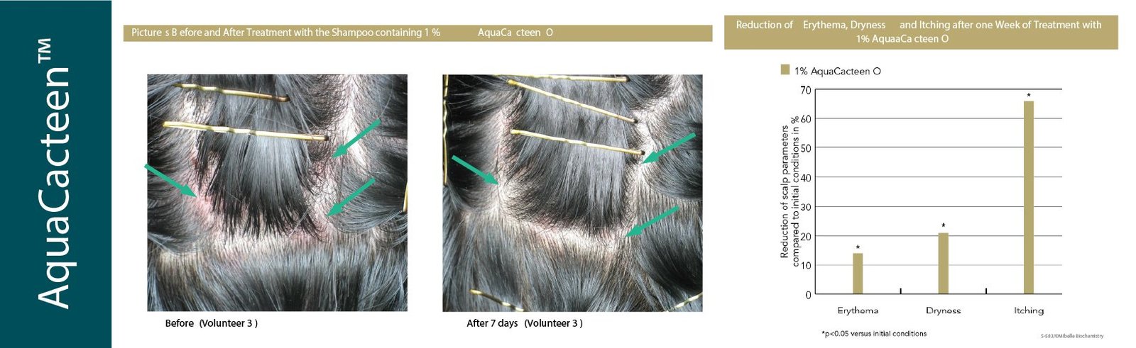 Aquacacteen-hairmd | Hairmd Clinical Series Products