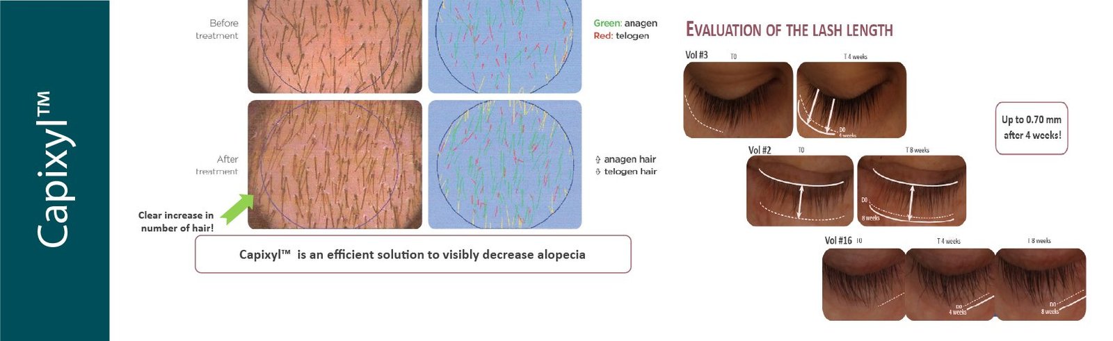 Capixly-hairmd | Hairmd Clinical Series Products