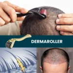 Demonstration of a dermaroller in a hair-care routine with close-up visuals